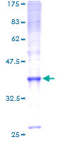 SLC10A7 Protein - 12.5% SDS-PAGE of human DKFZP566M114 stained with Coomassie Blue