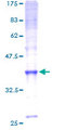 SLC10A7 Protein - 12.5% SDS-PAGE of human DKFZP566M114 stained with Coomassie Blue