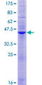 SLC11A1 / NRAMP Protein - 12.5% SDS-PAGE of human SLC11A1 stained with Coomassie Blue