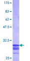 SLC11A1 / NRAMP Protein - 12.5% SDS-PAGE Stained with Coomassie Blue.