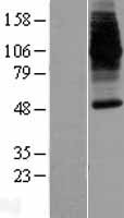 SLC11A2 / DMT1 Protein - Western validation with an anti-DDK antibody * L: Control HEK293 lysate R: Over-expression lysate