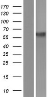 SLC11A2 / DMT1 Protein - Western validation with an anti-DDK antibody * L: Control HEK293 lysate R: Over-expression lysate