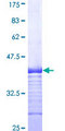 SLC11A2 / DMT1 Protein - 12.5% SDS-PAGE Stained with Coomassie Blue.