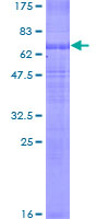 SLC12A1 / NKCC2 Protein - 12.5% SDS-PAGE of human SLC12A1 stained with Coomassie Blue