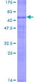 SLC12A1 / NKCC2 Protein - 12.5% SDS-PAGE of human SLC12A1 stained with Coomassie Blue