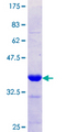 SLC12A1 / NKCC2 Protein - 12.5% SDS-PAGE Stained with Coomassie Blue.