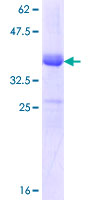 SLC12A2 / NKCC1 Protein - 12.5% SDS-PAGE Stained with Coomassie Blue.