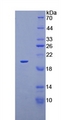 SLC12A3 / TSC Protein - Recombinant Na-Cl Cotransporter By SDS-PAGE