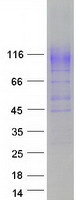 SLC12A3 / TSC Protein - Purified recombinant protein SLC12A3 was analyzed by SDS-PAGE gel and Coomassie Blue Staining
