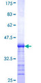 SLC12A6 / KCC3 Protein - 12.5% SDS-PAGE Stained with Coomassie Blue.