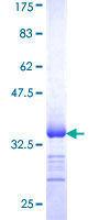 SLC13A2 / NaCT Protein - 12.5% SDS-PAGE Stained with Coomassie Blue.
