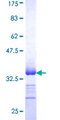 SLC13A2 / NaCT Protein - 12.5% SDS-PAGE Stained with Coomassie Blue.