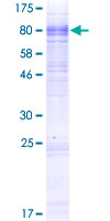 SLC13A3 Protein - 12.5% SDS-PAGE of human SLC13A3 stained with Coomassie Blue