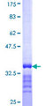 SLC13A3 Protein - 12.5% SDS-PAGE Stained with Coomassie Blue.