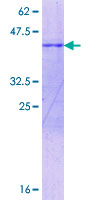 SLC13A4 Protein - 12.5% SDS-PAGE Stained with Coomassie Blue.