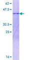SLC13A4 Protein - 12.5% SDS-PAGE Stained with Coomassie Blue.