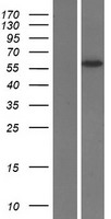 SLC13A5 Protein - Western validation with an anti-DDK antibody * L: Control HEK293 lysate R: Over-expression lysate