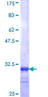 SLC13A5 Protein - 12.5% SDS-PAGE Stained with Coomassie Blue.