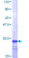 SLC13A5 Protein - 12.5% SDS-PAGE Stained with Coomassie Blue.