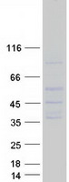 SLC14A1 / JK Protein - Purified recombinant protein SLC14A1 was analyzed by SDS-PAGE gel and Coomassie Blue Staining