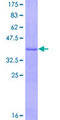 SLC14A2 / UTR Protein - 12.5% SDS-PAGE Stained with Coomassie Blue.