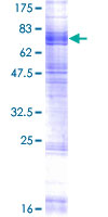 SLC15A3 Protein - 12.5% SDS-PAGE of human SLC15A3 stained with Coomassie Blue