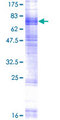 SLC15A3 Protein - 12.5% SDS-PAGE of human SLC15A3 stained with Coomassie Blue