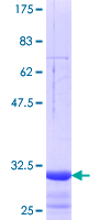 SLC15A3 Protein - 12.5% SDS-PAGE Stained with Coomassie Blue.