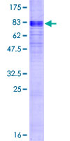 SLC16A1 / MCT1 Protein - 12.5% SDS-PAGE of human SLC16A1 stained with Coomassie Blue
