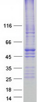 SLC16A1 / MCT1 Protein - Purified recombinant protein SLC16A1 was analyzed by SDS-PAGE gel and Coomassie Blue Staining