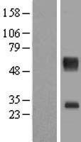 SLC16A11 Protein - Western validation with an anti-DDK antibody * L: Control HEK293 lysate R: Over-expression lysate