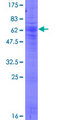 SLC17A3 Protein - 12.5% SDS-PAGE of human SLC17A3 stained with Coomassie Blue