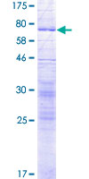 SLC17A4 Protein - 12.5% SDS-PAGE of human SLC17A4 stained with Coomassie Blue