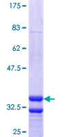 SLC17A4 Protein - 12.5% SDS-PAGE Stained with Coomassie Blue.