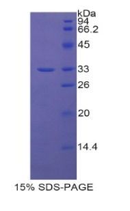 SLC17A5 Protein - Recombinant Anion/Sugar Transporter By SDS-PAGE