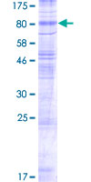 SLC17A7 / VGLUT1 Protein - 12.5% SDS-PAGE of human SLC17A7 stained with Coomassie Blue