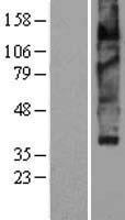 SLC18A2 / VMAT2 Protein - Western validation with an anti-DDK antibody * L: Control HEK293 lysate R: Over-expression lysate