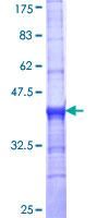 SLC18A2 / VMAT2 Protein - 12.5% SDS-PAGE Stained with Coomassie Blue.
