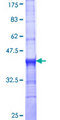 SLC18A2 / VMAT2 Protein - 12.5% SDS-PAGE Stained with Coomassie Blue.