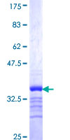 SLC18A3 / VACHT Protein - 12.5% SDS-PAGE Stained with Coomassie Blue.