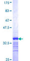 SLC18A3 / VACHT Protein - 12.5% SDS-PAGE Stained with Coomassie Blue.