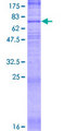 SLC19A1 Protein - 12.5% SDS-PAGE of human SLC19A1 stained with Coomassie Blue