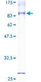 SLC1A1 / EAAT3 Protein - 12.5% SDS-PAGE of human SLC1A1 stained with Coomassie Blue