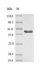 SLC1A1 / EAAT3 Protein - (Tris-Glycine gel) Discontinuous SDS-PAGE (reduced) with 5% enrichment gel and 15% separation gel.