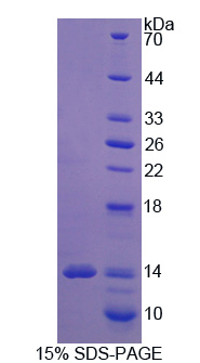SLC1A1 / EAAT3 Protein - Recombinant Excitatory Amino Acid Transporter 3 By SDS-PAGE