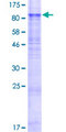 SLC1A2 / EAAT2 / GLT-1 Protein - 12.5% SDS-PAGE of human SLC1A2 stained with Coomassie Blue