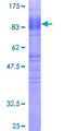 SLC1A3 / EAAT1 Protein - 12.5% SDS-PAGE of human SLC1A3 stained with Coomassie Blue