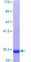 SLC1A3 / EAAT1 Protein - 12.5% SDS-PAGE Stained with Coomassie Blue.
