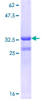 SLC1A4 / ASCT1 Protein - 12.5% SDS-PAGE Stained with Coomassie Blue.