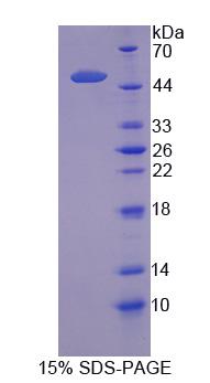 SLC1A5 / ASCT2 Protein - Recombinant  Solute Carrier Family 1, Member 5 By SDS-PAGE